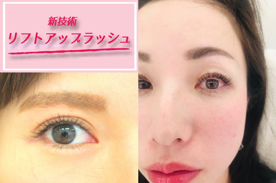 リフトアップラッシュ